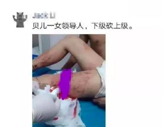 【 贝尔链 BRC 】 这带血的“馒头”吃的可真香····